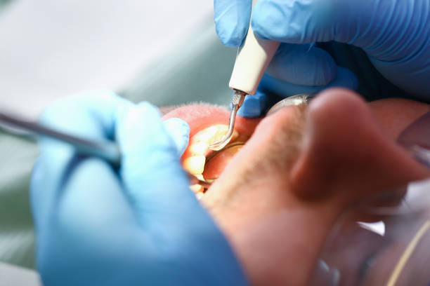 Best Emergency Dental Care for Abscessed Tooth in Alva, OK