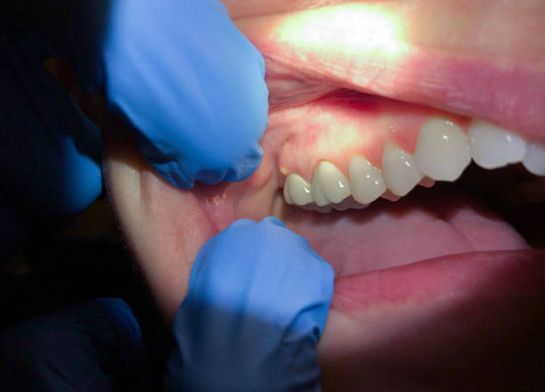 Best Emergency Dentist for Knocked-Out Tooth in Alva, OK